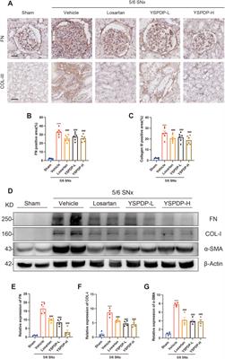 Yishen paidu pills attenuates 5/6 nephrectomy induced kidney disease via inhibiting the PI3K/AKT/mTOR signaling pathway